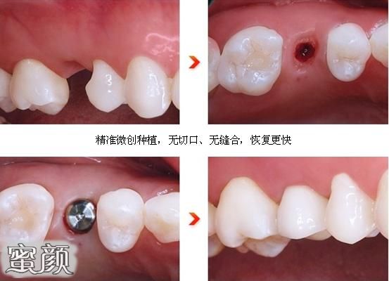 https://img.yiyiaimei.com/mnt/Editor/2020-07-02/5efd49e91a785.jpg