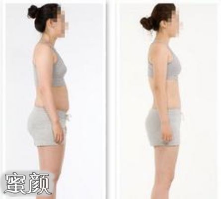 案例图片