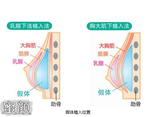 案例图片