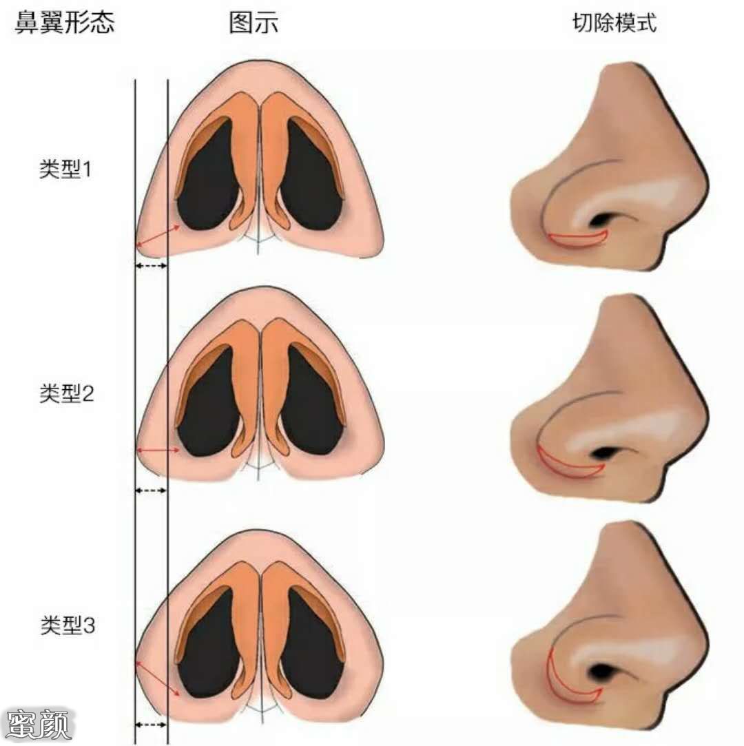 案例图片