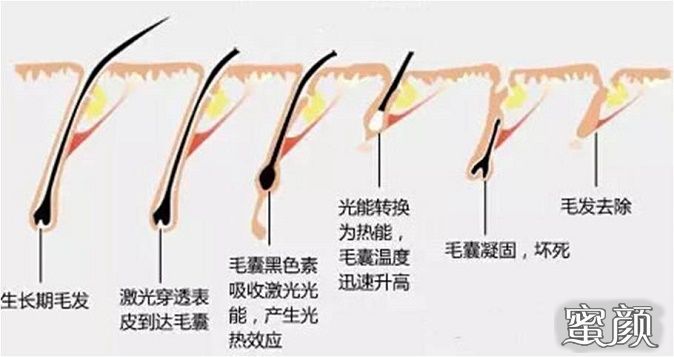 https://img.yiyiaimei.com/mnt/Editor/2020-07-11/5f09c6ec5ec5c.jpg