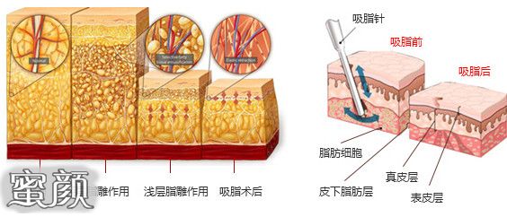 案例图片