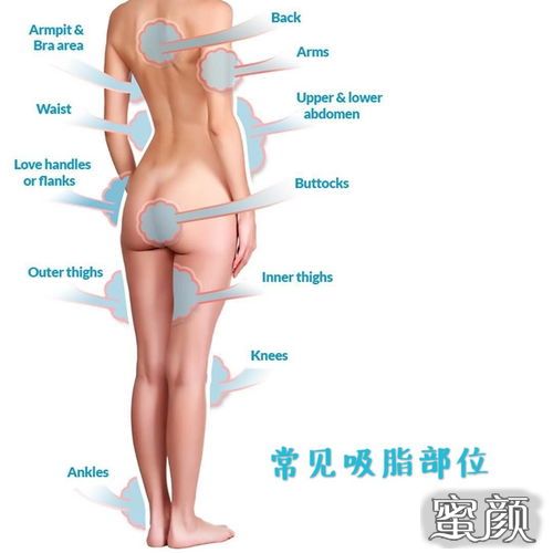 案例图片