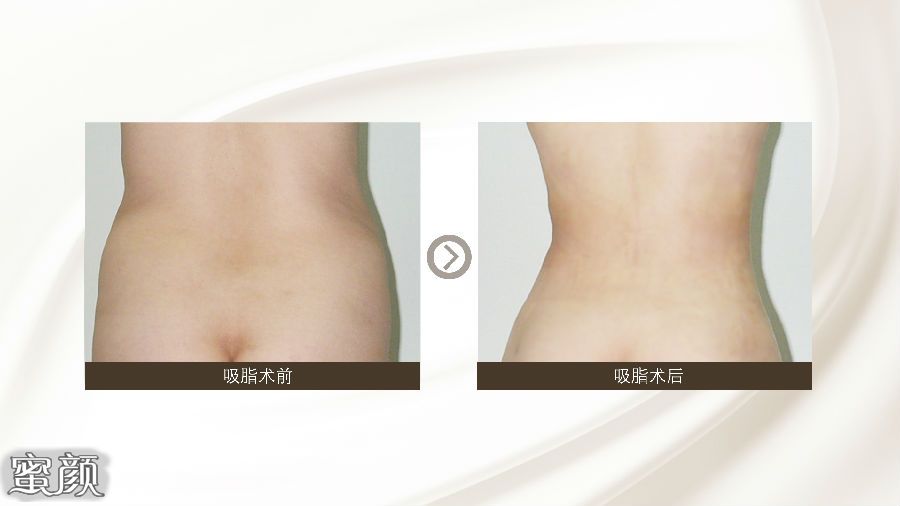 https://img.yiyiaimei.com/mnt/Editor/2020-07-17/5f11395d7ee7b.jpg