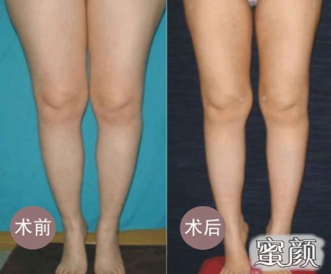 https://img.yiyiaimei.com/mnt/Editor/2020-07-17/5f11a7c0cc195.jpg