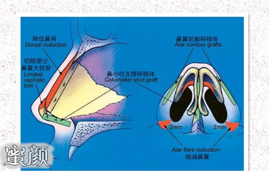 案例图片