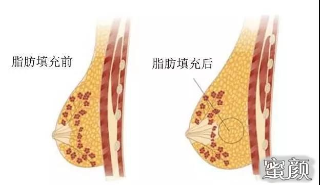 https://img.yiyiaimei.com/mnt/Editor/2020-07-24/5f1ac4ce67564.jpg