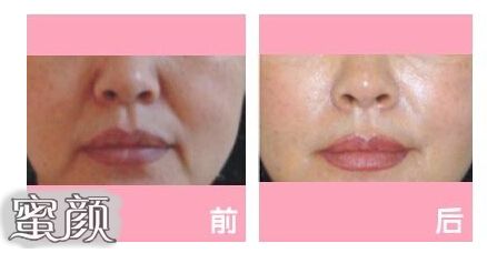 https://img.yiyiaimei.com/mnt/Editor/2020-07-26/5f1cf49179b4c.jpg