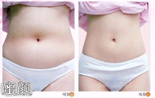 https://img.yiyiaimei.com/mnt/Editor/2020-07-28/5f20322d16b56.jpg