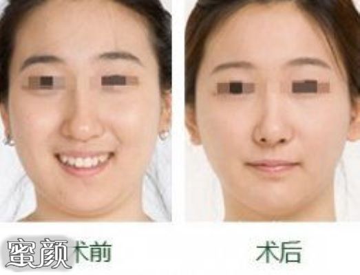 案例图片
