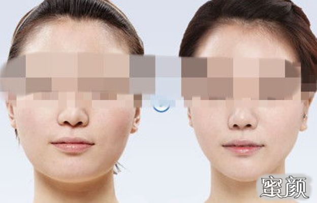 案例图片