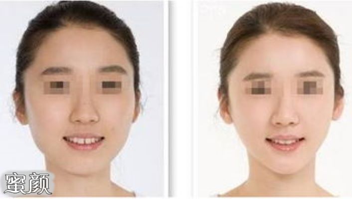案例图片