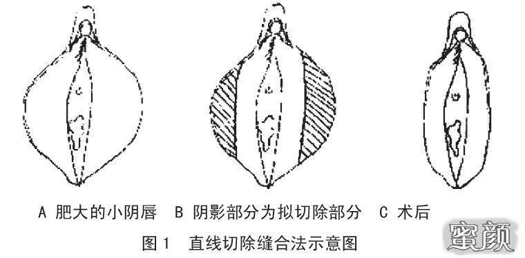 案例图片