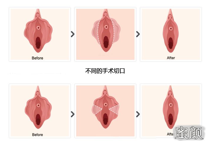 案例图片