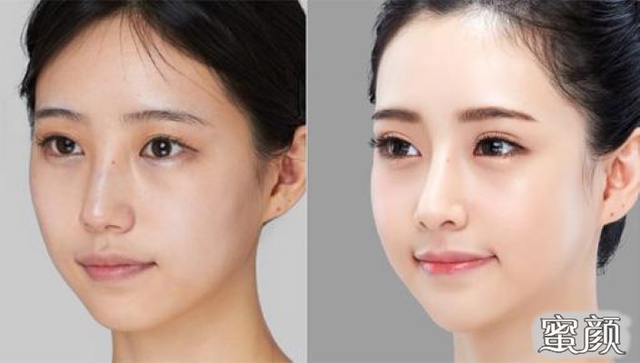https://img.yiyiaimei.com/mnt/Editor/2020-08-04/5f294a74848ec.jpg