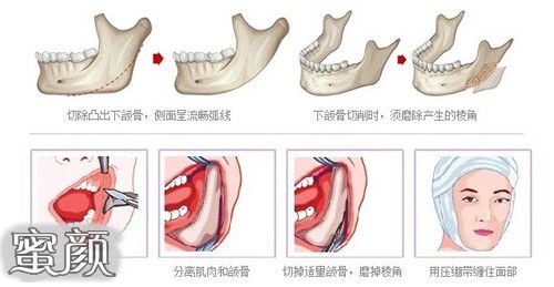 案例图片