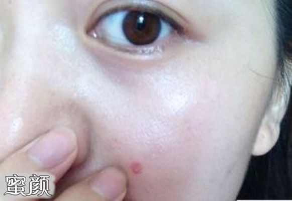 https://img.yiyiaimei.com/mnt/Editor/2020-08-05/5f2ad0d9a66b6.jpg