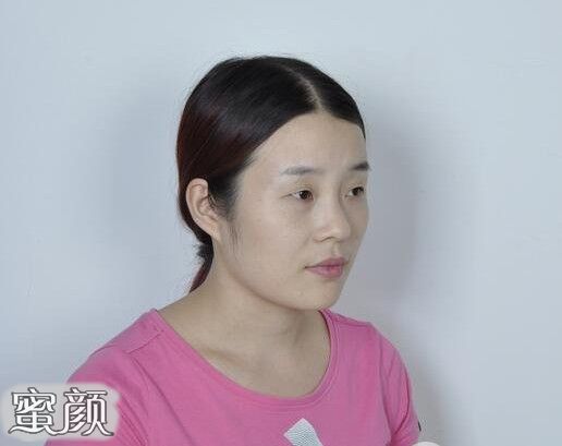 案例图片