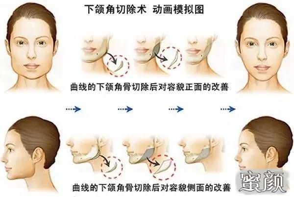 案例图片