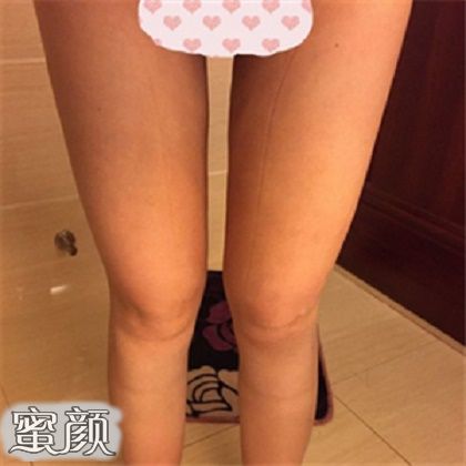 案例图片