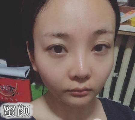 https://img.yiyiaimei.com/mnt/Editor/2020-08-08/5f2e757b74b9a.jpg