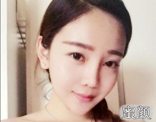 https://img.yiyiaimei.com/mnt/Editor/2020-08-08/5f2e758a64323.jpg