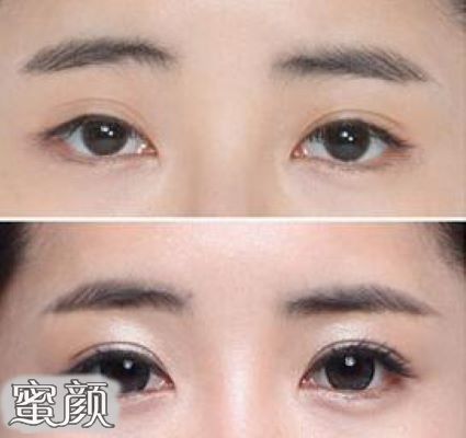 案例图片