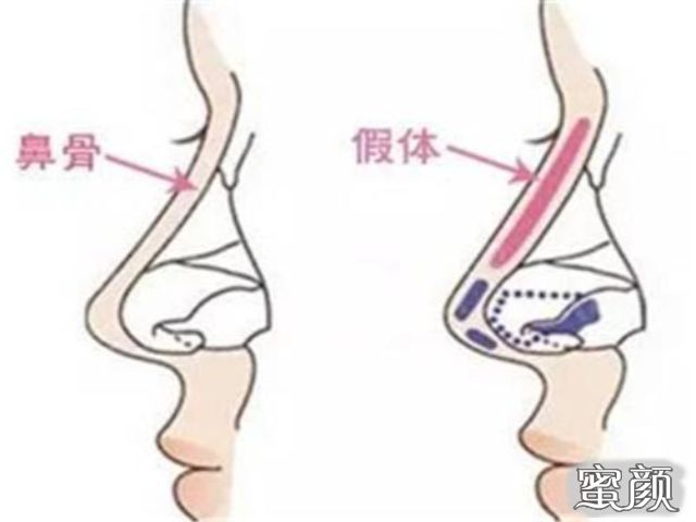 案例图片