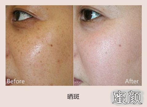 https://img.yiyiaimei.com/mnt/Editor/2020-08-16/5f3947dc332e9.jpg