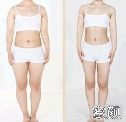 案例图片