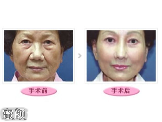 案例图片