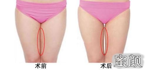 https://img.yiyiaimei.com/mnt/Editor/2020-08-30/5f4ba6ecd77f8.jpg