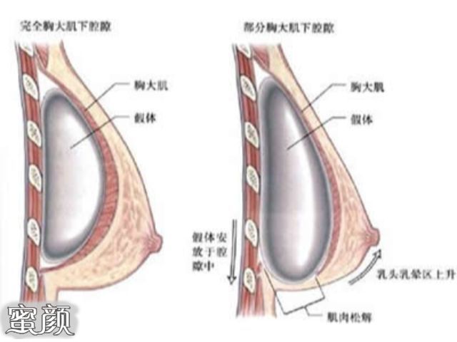 案例图片