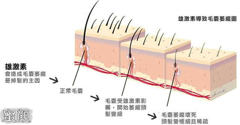 案例图片