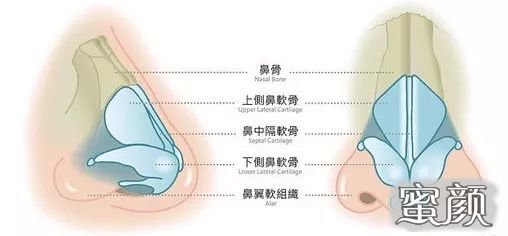 案例图片