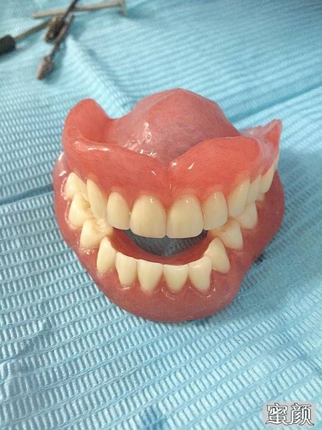 案例图片