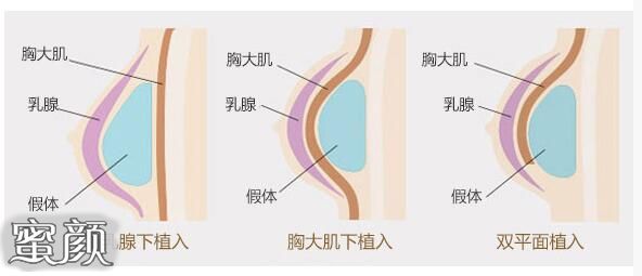 案例图片