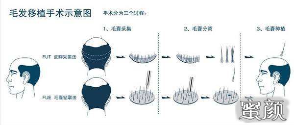 案例图片