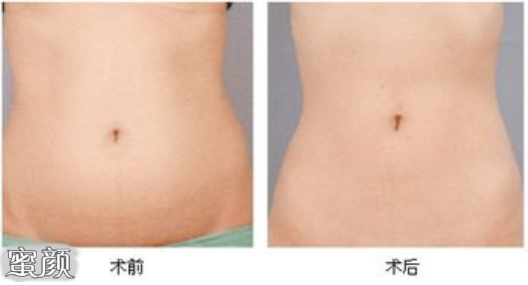https://img.yiyiaimei.com/mnt/Editor/2020-09-07/5f55b3cfdc61a.jpg