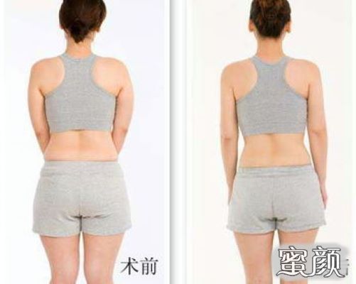 https://img.yiyiaimei.com/mnt/Editor/2020-09-07/5f55b3e264489.jpg