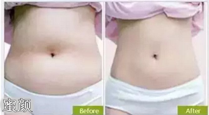 https://img.yiyiaimei.com/mnt/Editor/2020-09-07/5f55fb3d1faf1.jpg