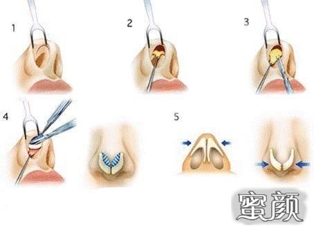 案例图片