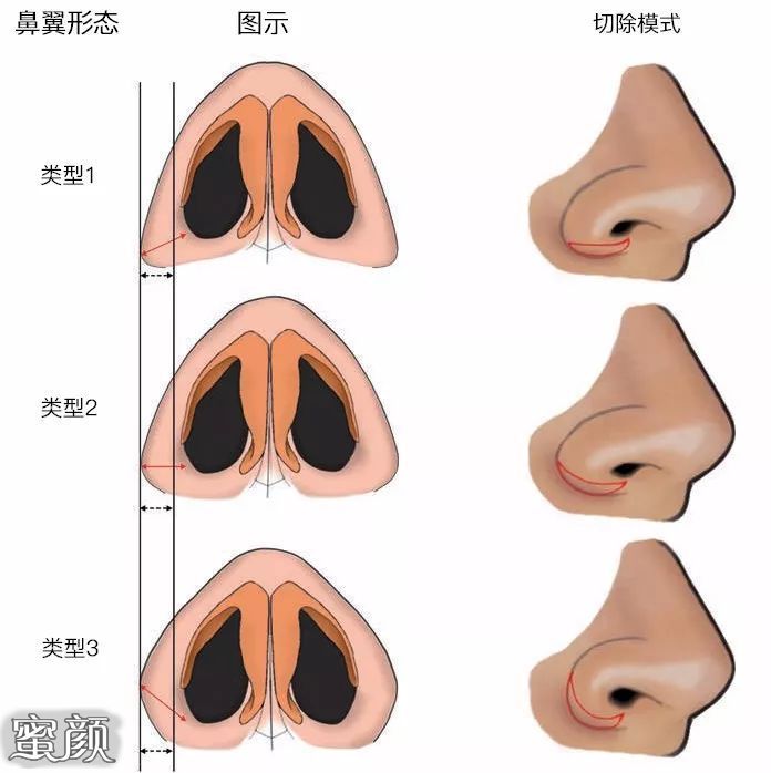 案例图片