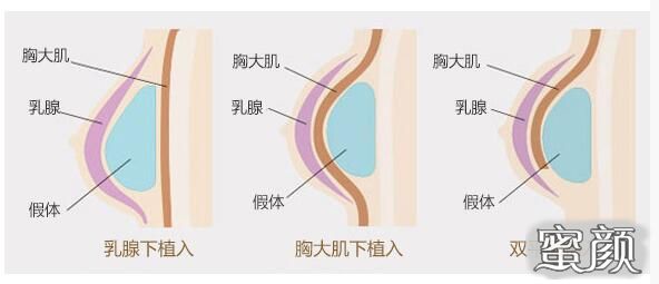 案例图片