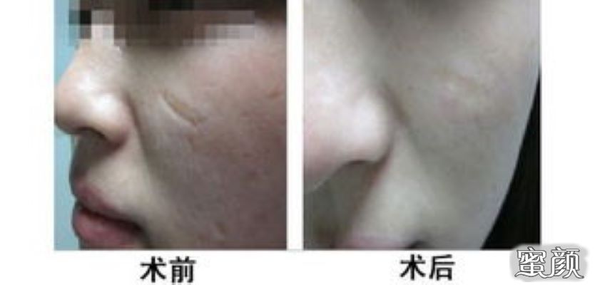 案例图片