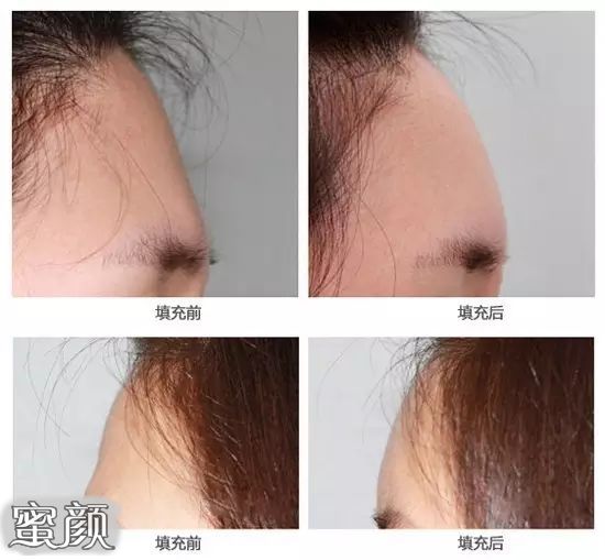 https://img.yiyiaimei.com/mnt/Editor/2020-09-15/5f5ffa094ac5e.jpg