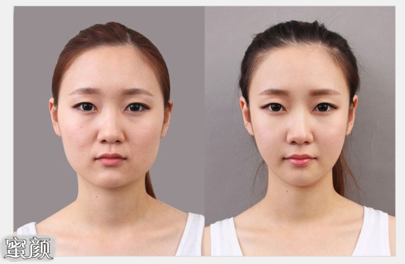 https://img.yiyiaimei.com/mnt/Editor/2020-09-15/5f607499b1072.jpg