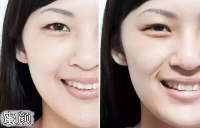 https://img.yiyiaimei.com/mnt/Editor/2020-09-15/5f6074d1984f0.jpg