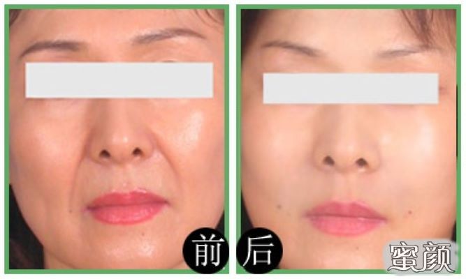 https://img.yiyiaimei.com/mnt/Editor/2020-09-15/5f60b49096349.jpg