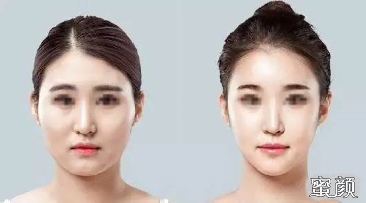 案例图片
